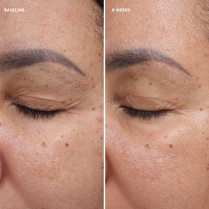 TOTAL EYE® FIRM & REPAIR CREAM