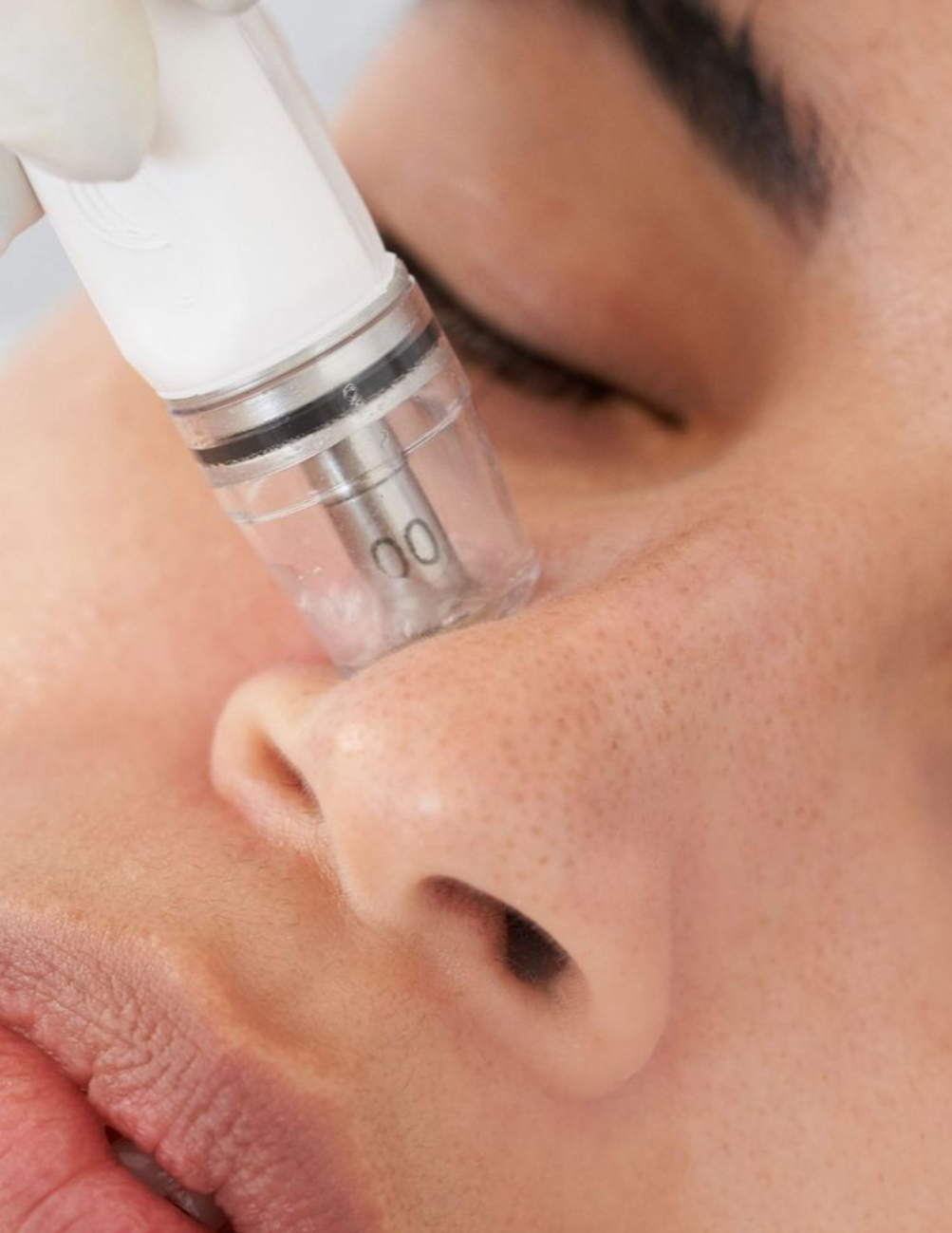 HydraFacial or Diamond Glow