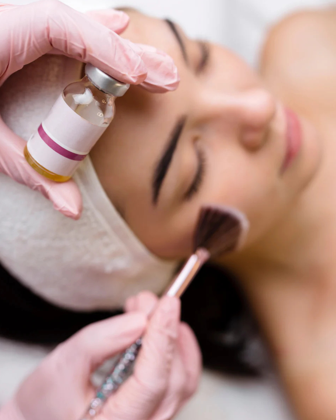 Chemical Peels