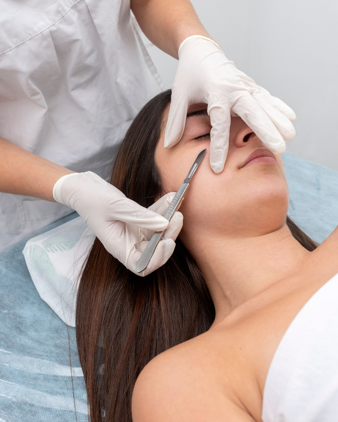 Dermaplaning