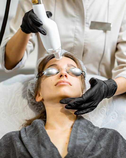 Pulse Dye Laser (PDL) or Excel V- Vascular Laser
