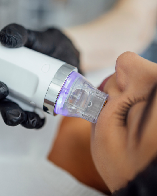Microneedling