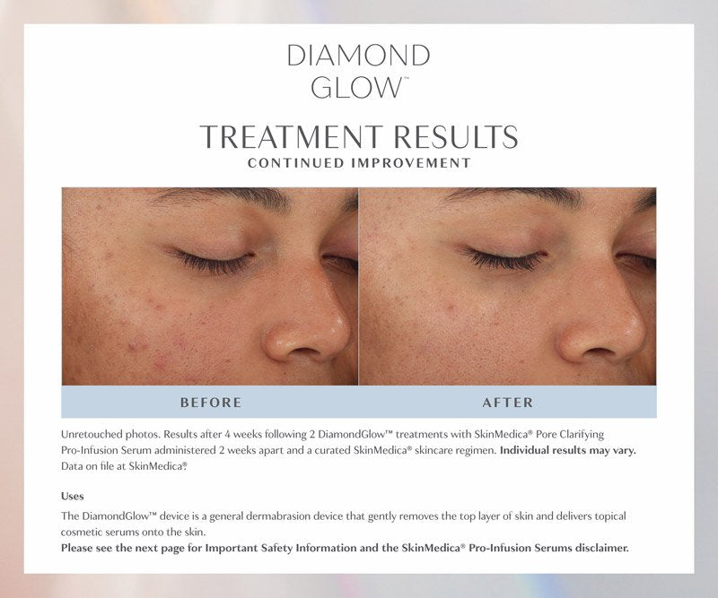 HydraFacial or Diamond Glow